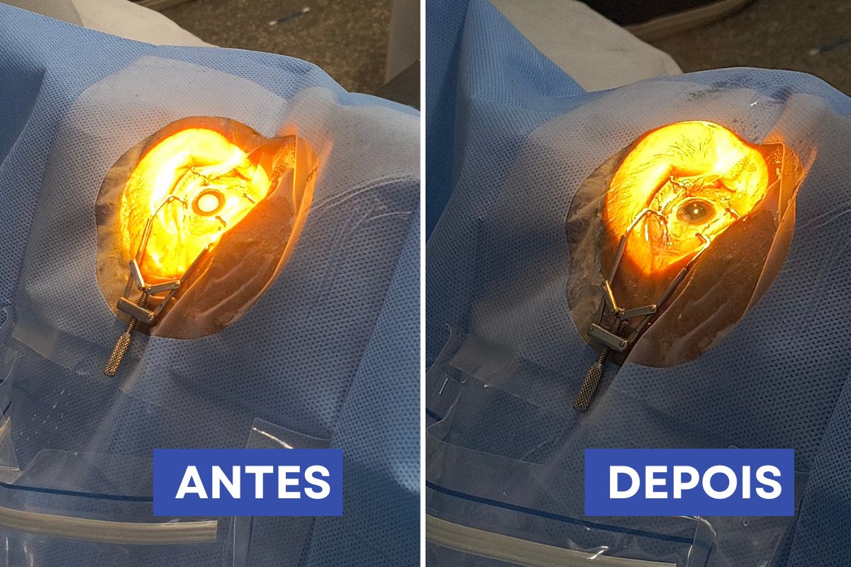 Foto: Victória Cavalcante/Prefeitura de Itacoatiara/Divulgação